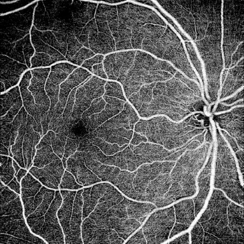正常網膜のOCTアンギオ画像